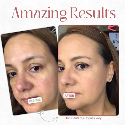 Natripaw™ Eye Cream – Reduce Puffiness, Dark Circles & Fine Lines