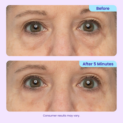 Buy More, Save More ✨Lift, Tighten & Smooth — Results You Can See Fast
