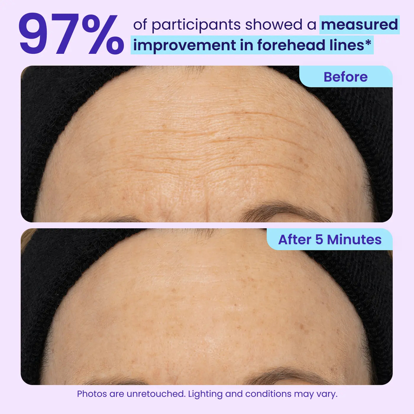 Buy More, Save More ✨Lift, Tighten & Smooth — Results You Can See Fast