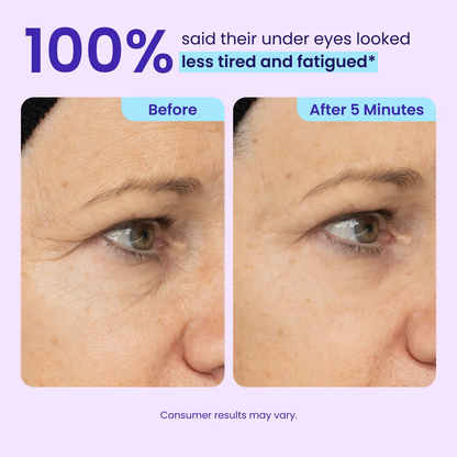 Buy More, Save More ✨Lift, Tighten & Smooth — Results You Can See Fast