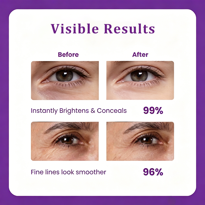 Natripaw™ Eye Cream – Reduce Puffiness, Dark Circles & Fine Lines
