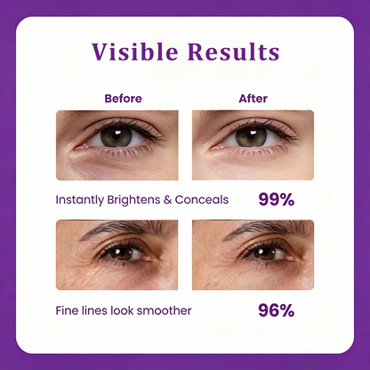 Natripaw™ Eye Cream – Reduce Puffiness, Dark Circles & Fine Lines